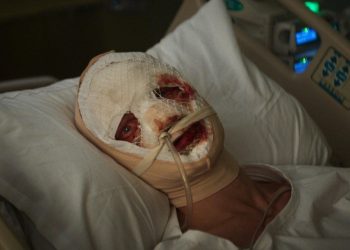 بوستر تشويقي جديد لفيلم «Clayface» يكشف تحولات مرعبة قبل عرضه في السينما 23 أكتوبر